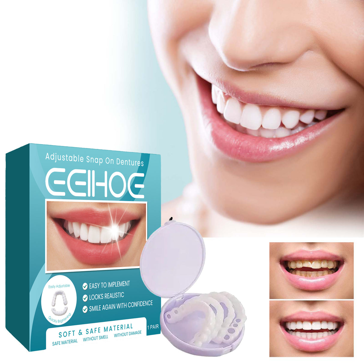 Adjustable Buckle Denture, Temporary Fillings Interdental Fillings Orthodontic Denture Kits - V.I.P Digital Presence