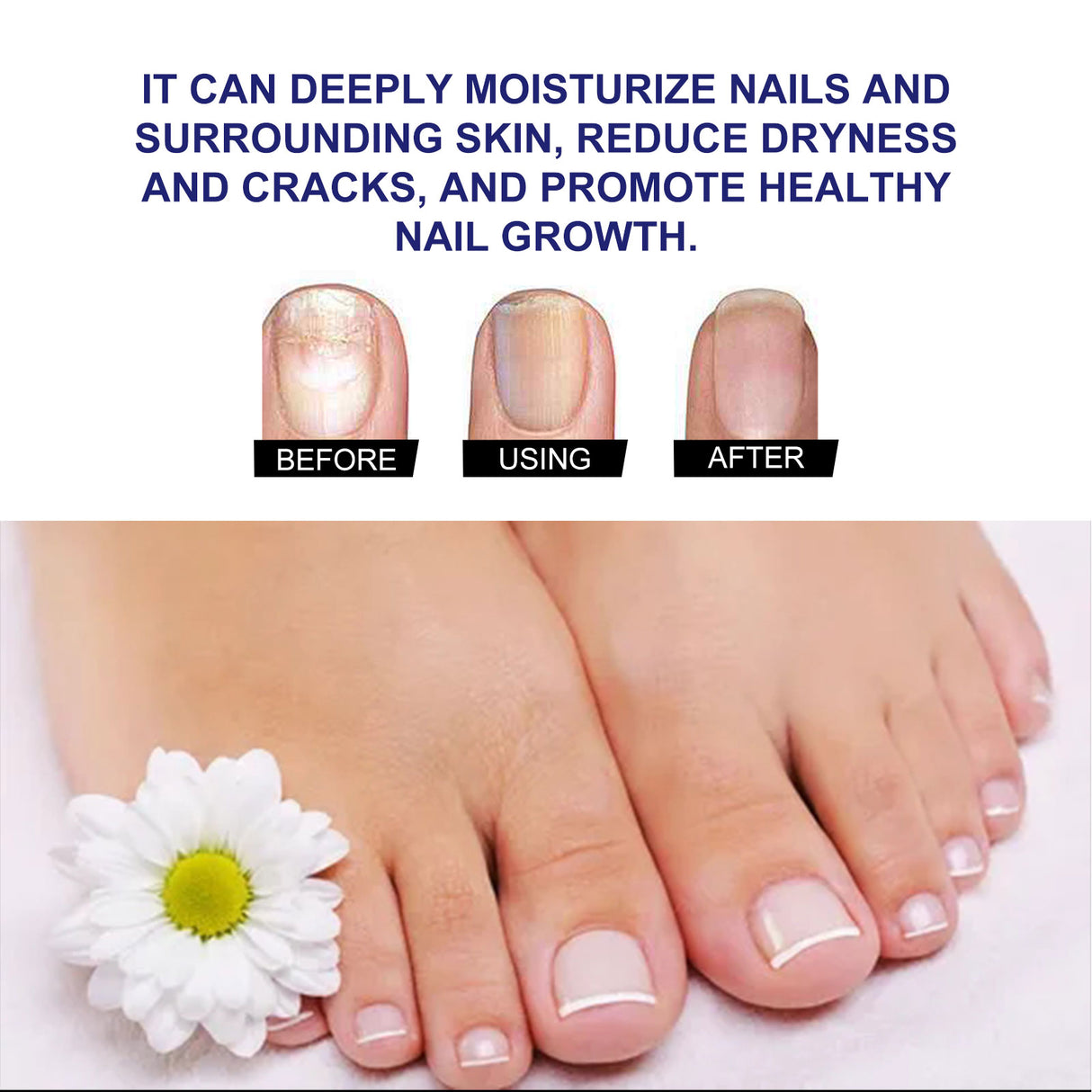 Plant Drops, Repair Extremities Soft Thickening Light Armour Moist Clean Fingernails Detailer - V.I.P Digital Presence