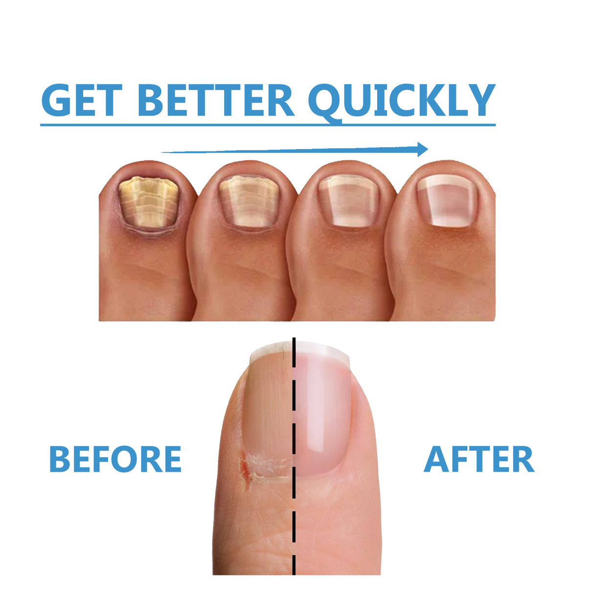 Toenail Fungus Treatment, Repair The Brotherhood Of Nails Rotten Jiasheng Mail This Soft Armour A Detailer - V.I.P Digital Presence