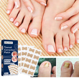 Nail Correction Patch, Nail Insert Correction And Repair Toe Manicure Nail Patch - V.I.P Digital Presence