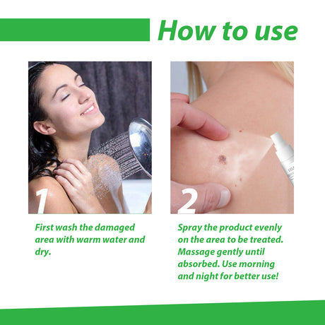 Skin Wart Removal Liquid, Skin Tag Cleaning Remove Hand And Foot Cocoon Corns Wart Removal Liquid - V.I.P Digital Presence
