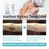 Acanthosis Nigricans Therapy Lotion, Skin Moisturizing Clean Black Dark Heavy Alar Knee Joint Repair Carry Bright Color Of Skin - V.I.P Digital Presence