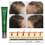 Scalp Essence Ginger Gently Moisturizes And Moisturizes Dry And Dry Hair - V.I.P Digital Presence