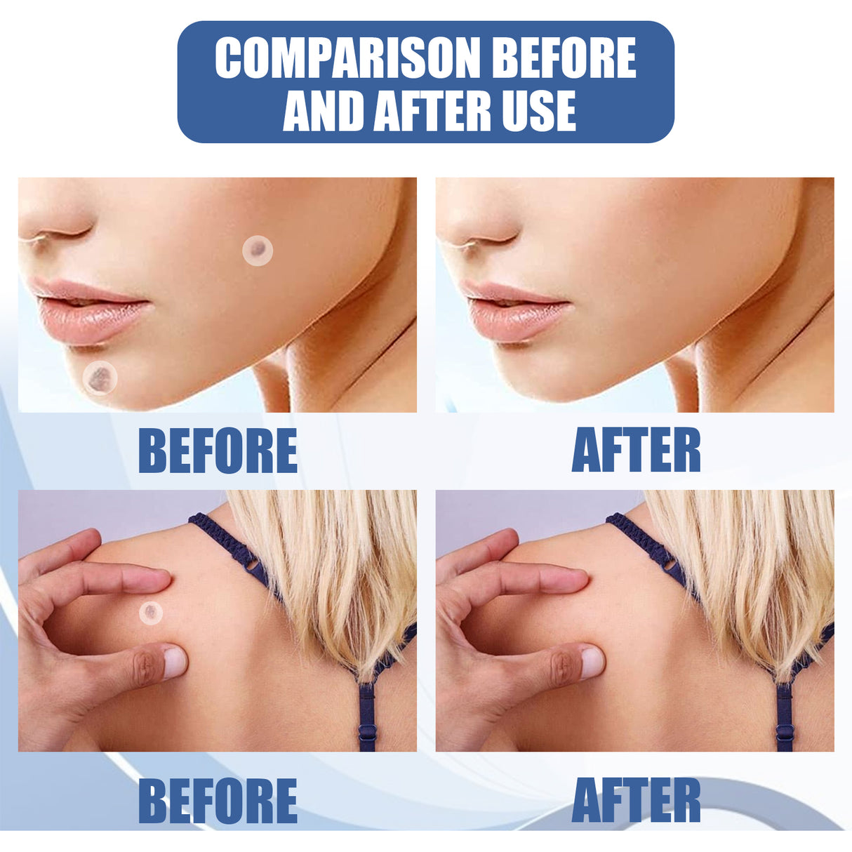 Kew Patch Gentle Cleaning Care Skin Face Neck Repair Smooth Skin Daily Care - V.I.P Digital Presence