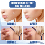 Kew Patch Gentle Cleaning Care Skin Face Neck Repair Smooth Skin Daily Care - V.I.P Digital Presence