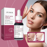 Fruit Acid Purifying Essence, Gentle Exfoliating, Moisturizing And Moisturizing Daily Skin Care Essence - V.I.P Digital Presence