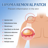 Lipoma Removal Patch, Soothing Various Body Fat Knots To Remove Subcutaneous Lumps Care Patch - V.I.P Digital Presence