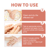 7 Day Nail Repair Essence, Hand And Foot Gray Nail Brightening Soft Nail Thickening Toenail Care Solution - V.I.P Digital Presence