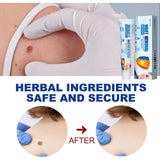 Keyu Cream Clean Skin Repair Care Body Face Remove Face Label Keyu Cream - V.I.P Digital Presence
