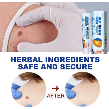 Keyu Cream Clean Skin Repair Care Body Face Remove Face Label Keyu Cream - V.I.P Digital Presence