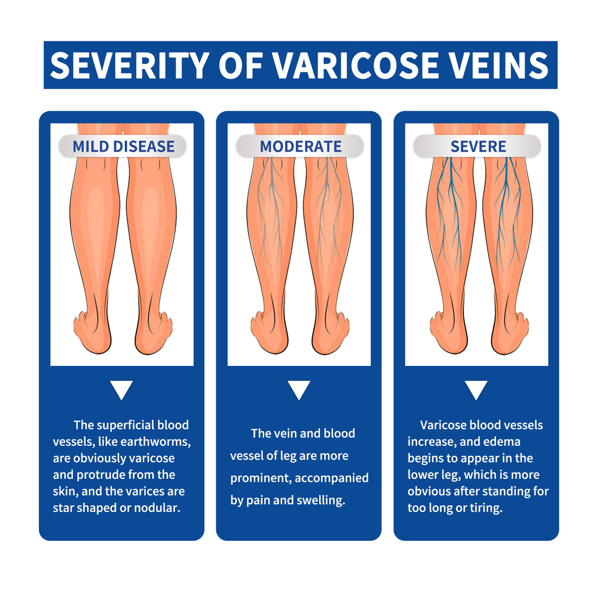 Leg Care Cream Relieves Leg Discomfort Pamper And Moisturize Skin Daily Massage Treatment - V.I.P Digital Presence