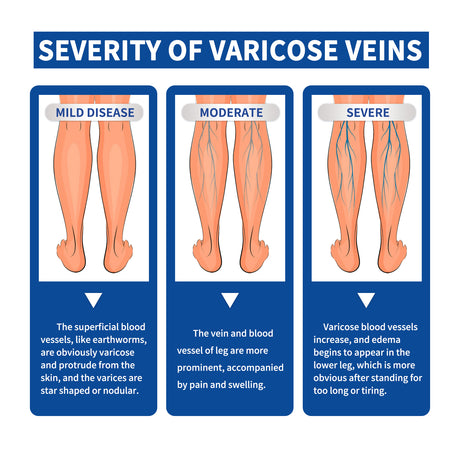Leg Care Cream Relieves Leg Discomfort Pamper And Moisturize Skin Daily Massage Treatment - V.I.P Digital Presence
