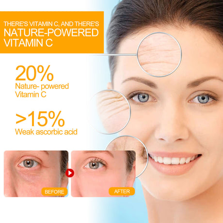 Vitamin C Anti-Aging Serum, Lighten Neck Lines And Facial Wrinkles, Firming And Tender Skin Anti-Wrinkle Serum - V.I.P Digital Presence