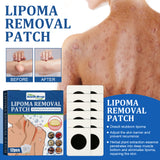Lipoma Removal Patch, Soothing Various Body Fat Knots To Remove Subcutaneous Lumps Care Patch - V.I.P Digital Presence