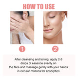 Nicotinamide Essence Tights And Moisturizes Pores, Lighens Acne Marks And Spots, Moisturizes And Brighens Skin - V.I.P Digital Presence