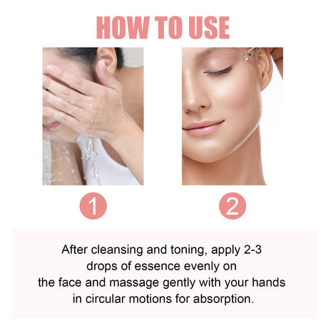 Nicotinamide Essence Tights And Moisturizes Pores, Lighens Acne Marks And Spots, Moisturizes And Brighens Skin - V.I.P Digital Presence