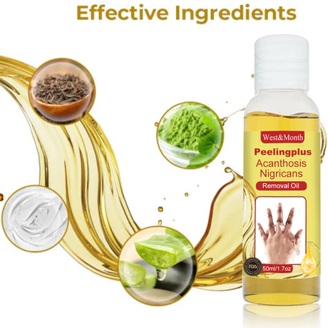 Acanthosis Nigricans Removal Oil, Exfoliating Light Black Brightening And Beauty Skin Oil - V.I.P Digital Presence