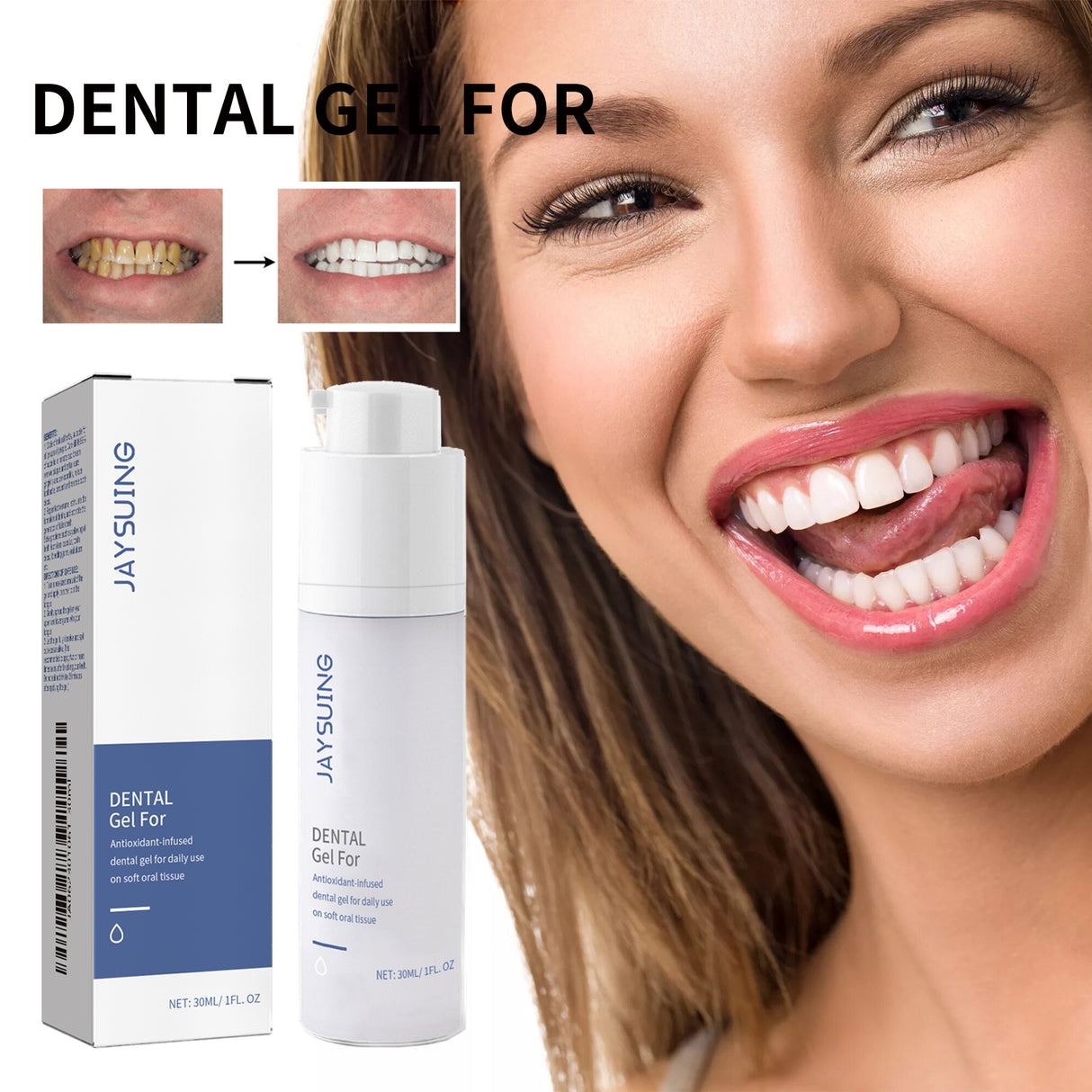 Tooth Gel For Tooth Cleaning Fresh Breath For Oral Cleaning - V.I.P Digital Presence