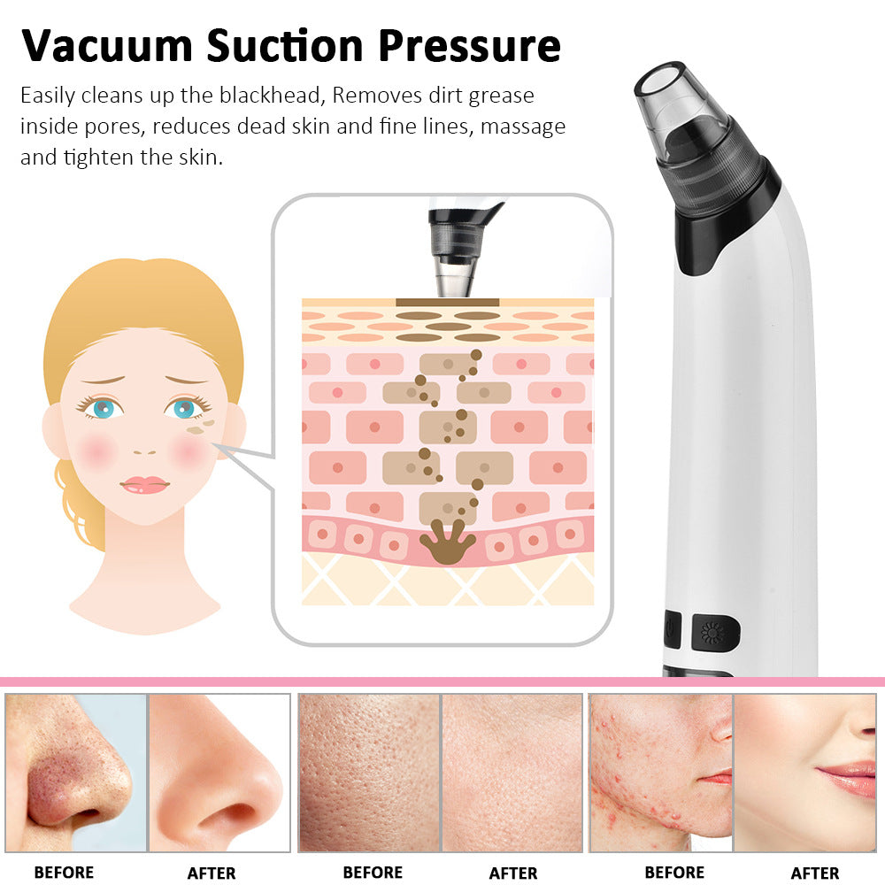 Heating Blackhead Instrument HailiCare Clean Pore Vacuum Cleansing Acne Acne Beauty Instrument - V.I.P Digital Presence