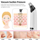 Heating Blackhead Instrument HailiCare Clean Pore Vacuum Cleansing Acne Acne Beauty Instrument - V.I.P Digital Presence
