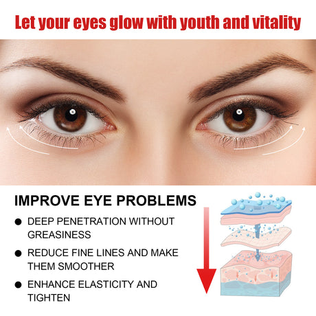 Nourishing And Moisturizing Eye Cream Keeps The Skin Around The Eyes Soft And Moisturized With A Gentle Daily Eye Cream - V.I.P Digital Presence