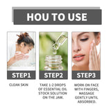 Snail Nourishing Repair Essence, Lightening Acne Muscle Acne Mark, Hydrating Whitening And Eliminate Pimples Essence - V.I.P Digital Presence