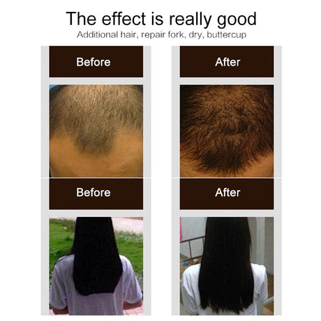 Purc 30ml Hair Growth Spray Natural Ginger Essence Spray Effective Extract Anti Hair Loss Nourish Root Hair Care Treatment - V.I.P Digital Presence