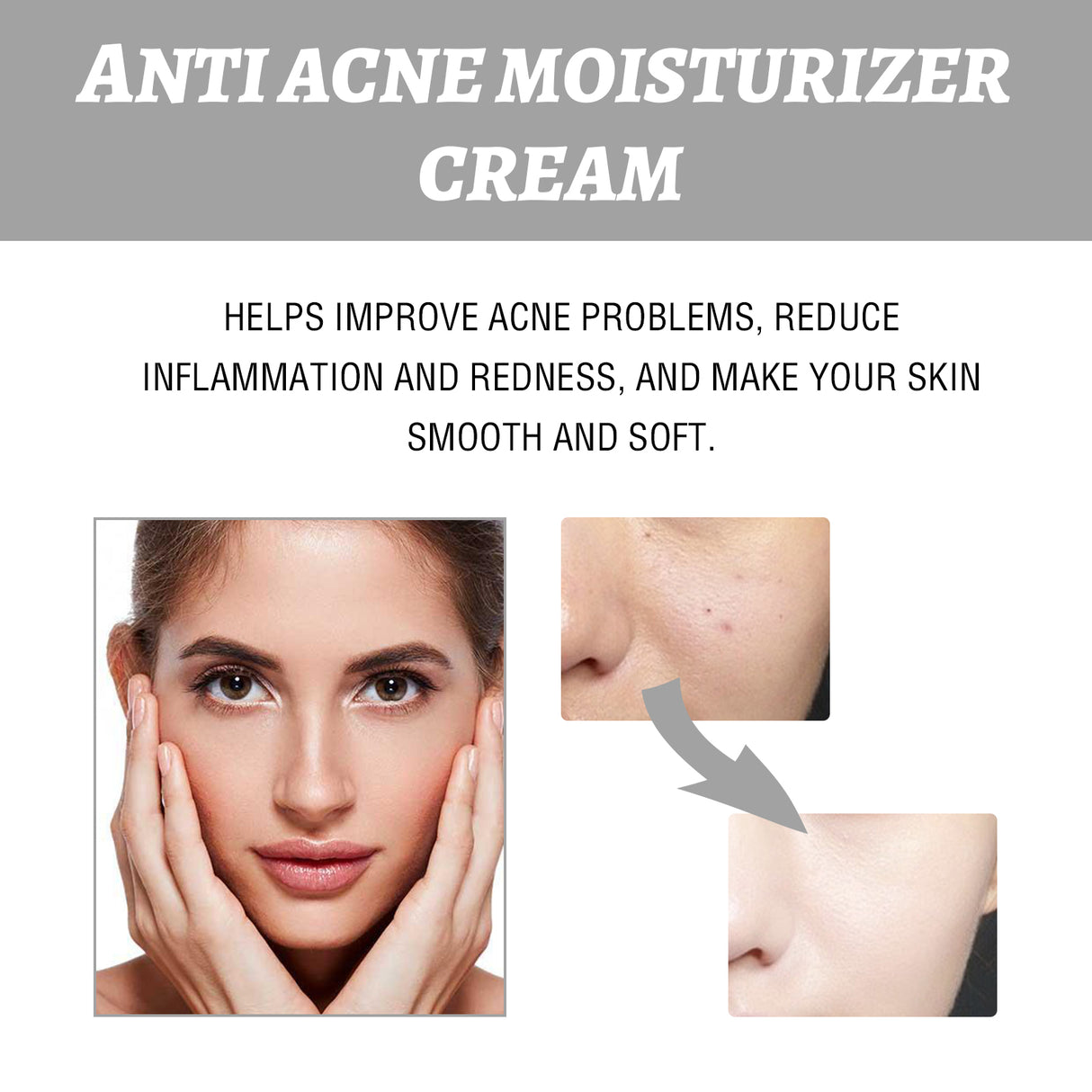 Hydrating Cream Hydrating And Lightening Facial Acne Repair Redness Hydrating And Brightening Moisturizing Cream - V.I.P Digital Presence