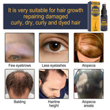 Dense Castor Oil Nutrient Solution, Hair Prevention, Moisturizing Hair Follicles Massage Repair Hair Hair - V.I.P Digital Presence