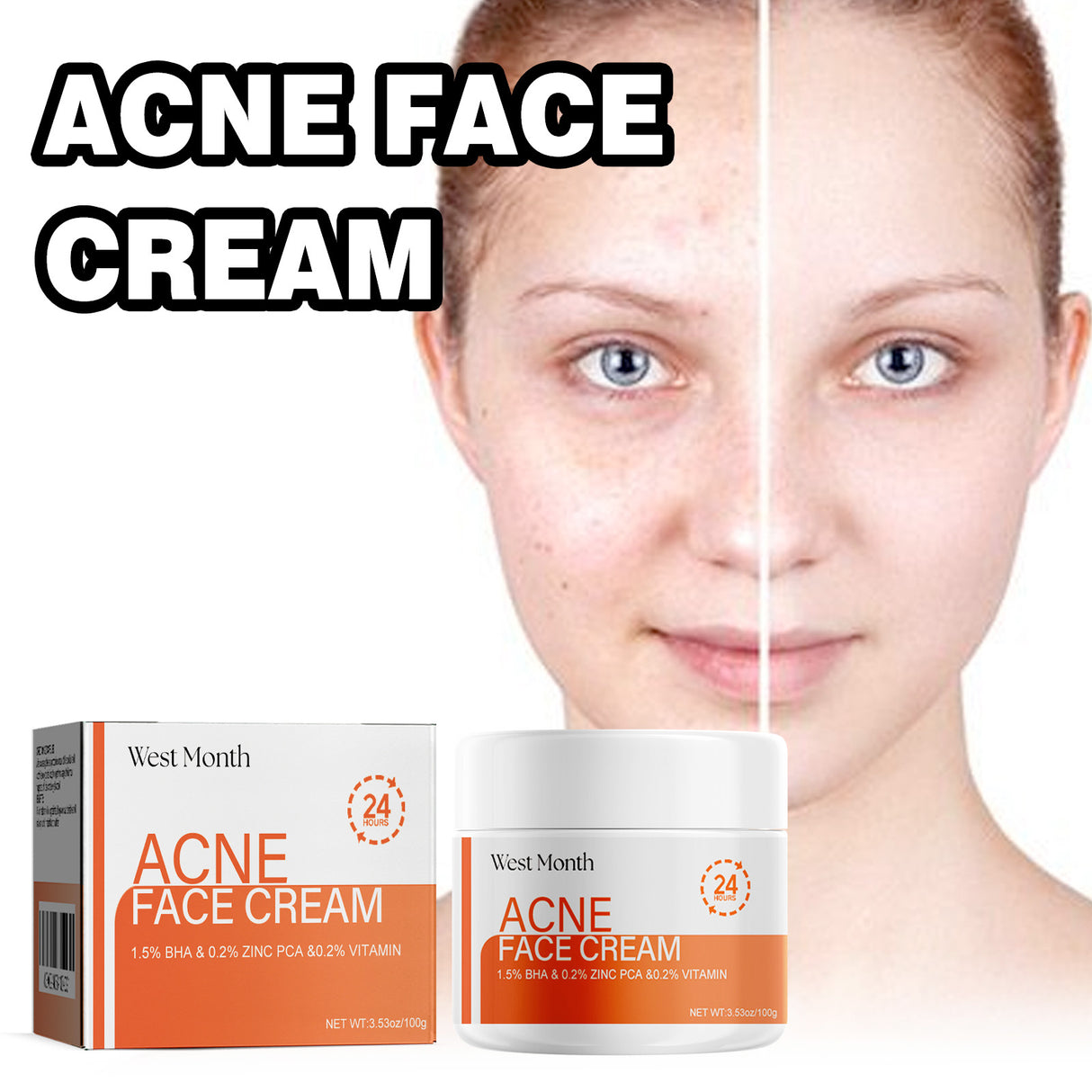 Salicylic Acid Facial Mask Gentle Cleansing Mask To Lighten Acne, Seal And Tighten Pores - V.I.P Digital Presence