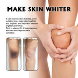 Whitening Skin, Lighten Dull Skin Elbow Black Hydrating, Brightening, Moisturizing And Rejuvenating Essence - V.I.P Digital Presence