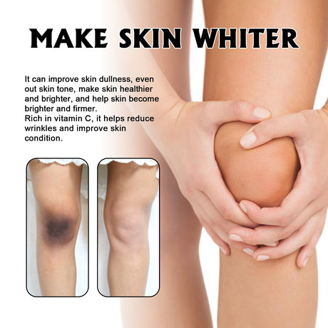Whitening Skin, Lighten Dull Skin Elbow Black Hydrating, Brightening, Moisturizing And Rejuvenating Essence - V.I.P Digital Presence