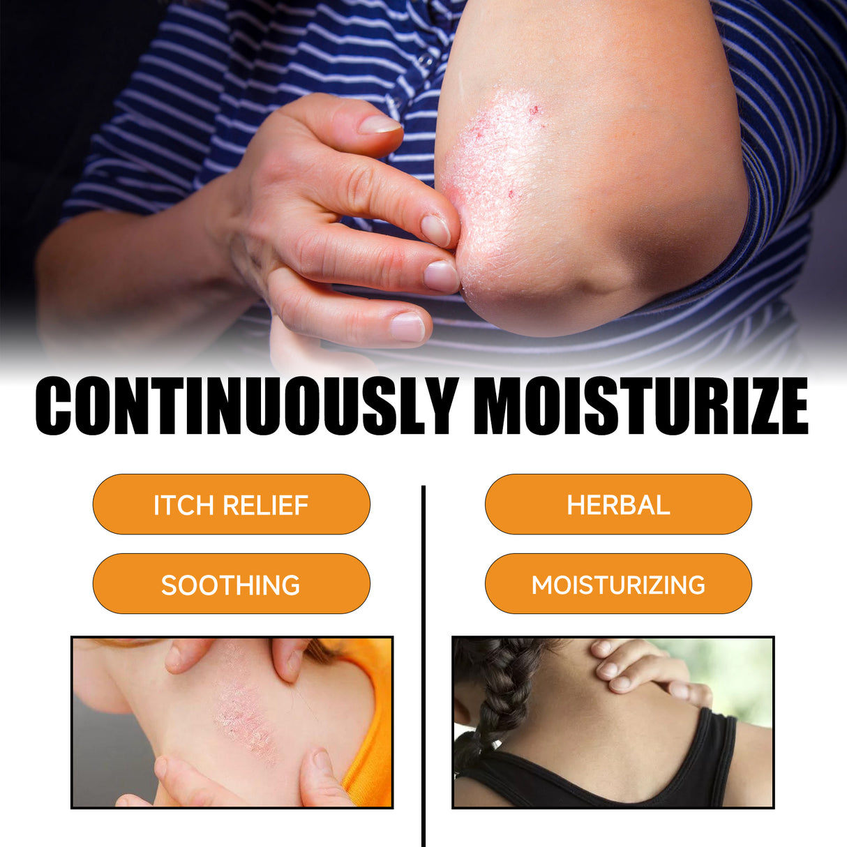 Bee Venom Psoriasis Care Spray, Soothing Skin Irritation Repair Moisturizing And Tender Skin Care Spray - V.I.P Digital Presence