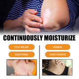 Bee Venom Psoriasis Care Spray, Soothing Skin Irritation Repair Moisturizing And Tender Skin Care Spray - V.I.P Digital Presence