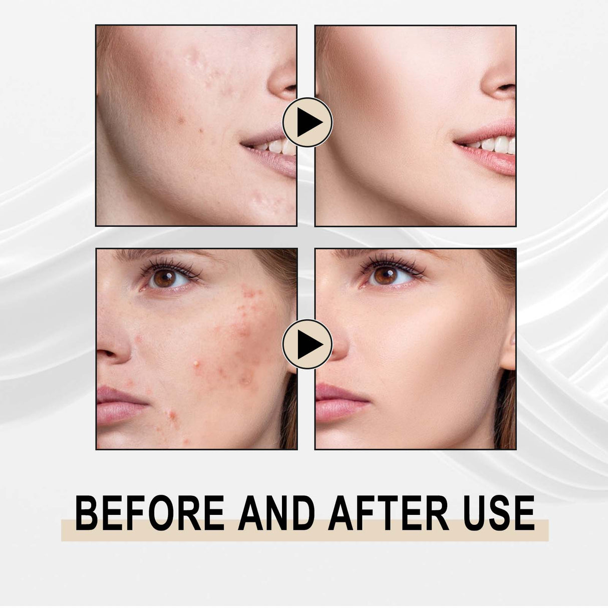 Lactose Solution, Exfoliate Remove Blackheads Shrink Pores Clean And Moisturize SkinEssence