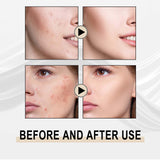 Lactose Solution, Exfoliate Remove Blackheads Shrink Pores Clean And Moisturize SkinEssence