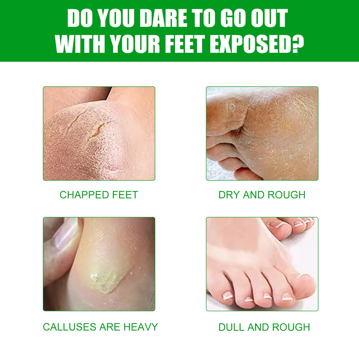 Aloe Vera Foot Mask, Moisturizing Anti-Cracking, Dead Skin Removal, Tender Skin Care Foot Mask - V.I.P Digital Presence