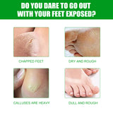 Aloe Vera Foot Mask, Moisturizing Anti-Cracking, Dead Skin Removal, Tender Skin Care Foot Mask - V.I.P Digital Presence