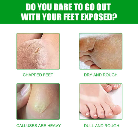 Aloe Vera Foot Mask, Moisturizing Anti-Cracking, Dead Skin Removal, Tender Skin Care Foot Mask - V.I.P Digital Presence