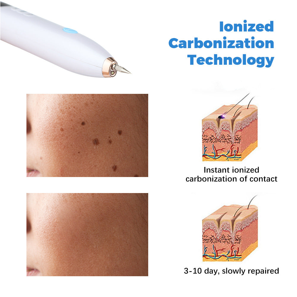 Removal Of Granulation Wart Tattoo Wart Spot Plug-In 9-Speed Laser Sweep Spot Mole Pen With Point Mole Pen Needle - V.I.P Digital Presence