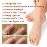 7 Day Nail Care Essence Grey Nail, Hand, Foot And Nail Nourishing Cleansing Essence