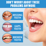 Tooth Repair Kit, Halloween Makeup Modification Teeth Dentures Fillings And Holes And Glue - V.I.P Digital Presence