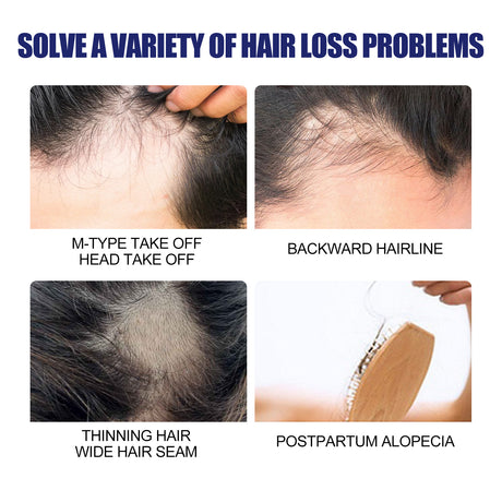 Men's Dense Hair Foam Machine, Repair Hair Root Follicle Men's Hair Thick Moisturizing Foam - V.I.P Digital Presence