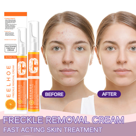 VC Beauty Pen, Moisturizing Facial Skin, Reduce Spots And Melanin Skin Beauty Pen - V.I.P Digital Presence