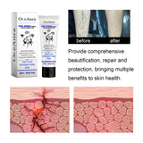 Tattoo Dissolving Gel, Moisturizing Tattoo Skin Repair Skin Tattoo Mark Brightening Care Cream - V.I.P Digital Presence