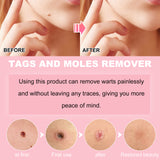 Skin Wart Lotion, Cleanses Skin And Removes Flat Eye Wart Lotion Especially Hand Cocoon - V.I.P Digital Presence