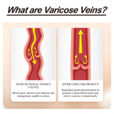 Chamomile Leg Essential Oil Protects Leg Skin And Relieves Leg Discomfort With Daily Massage Essential Oil - V.I.P Digital Presence