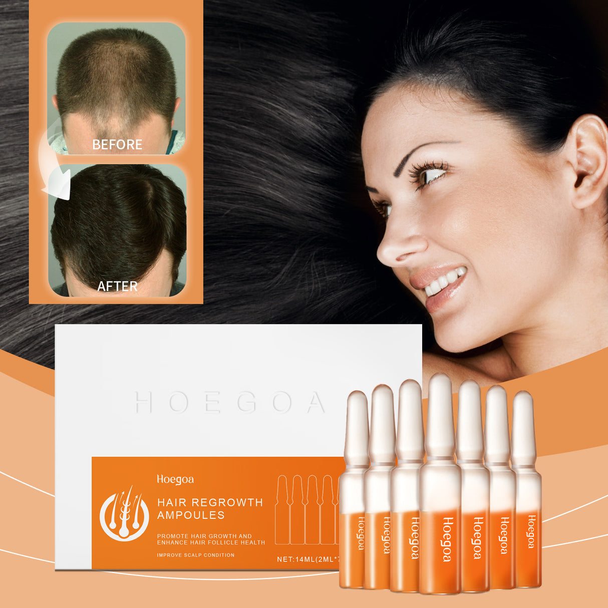 Hair Regrowth Ampoules, Nourish The Scalp To Promote Germinal Nourish Hair Follicle Health Care Essence - V.I.P Digital Presence