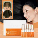 Hair Regrowth Ampoules, Nourish The Scalp To Promote Germinal Nourish Hair Follicle Health Care Essence - V.I.P Digital Presence