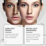 Dark Spot Repair Lotion Moisturizes And Hydrates Facial Skin With Skin Care Spot Repair Lotion